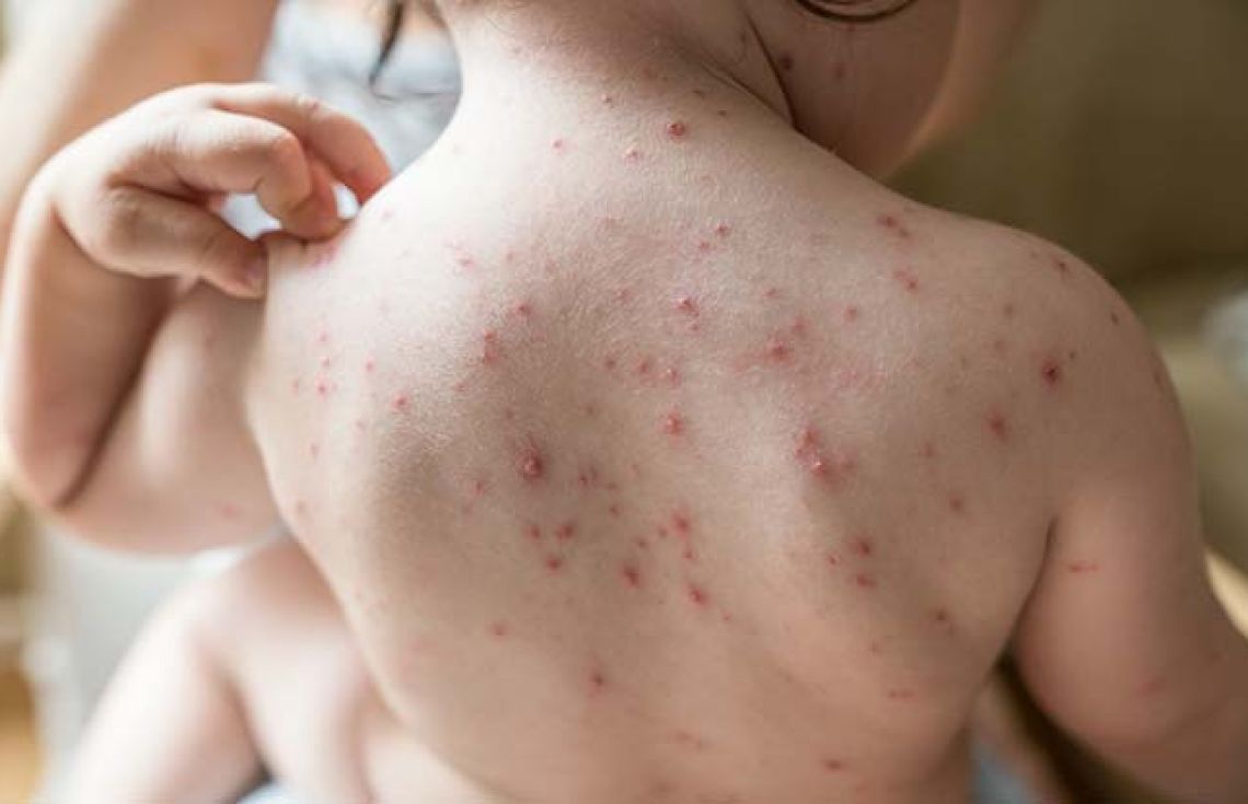 ފާނަބަސަންދުގެ ކޭސްތައް އިތުރުވެއްޖެ