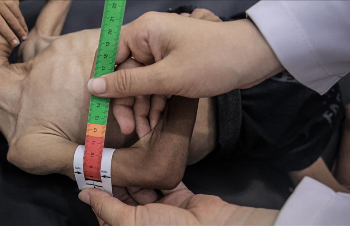 ނިއުޓްރިޝަން ނުލިބިގެން ޣައްޒާގެ ހުރިހާ ކުޑަކުދިން އަނަރޫފަވެއްޖެ