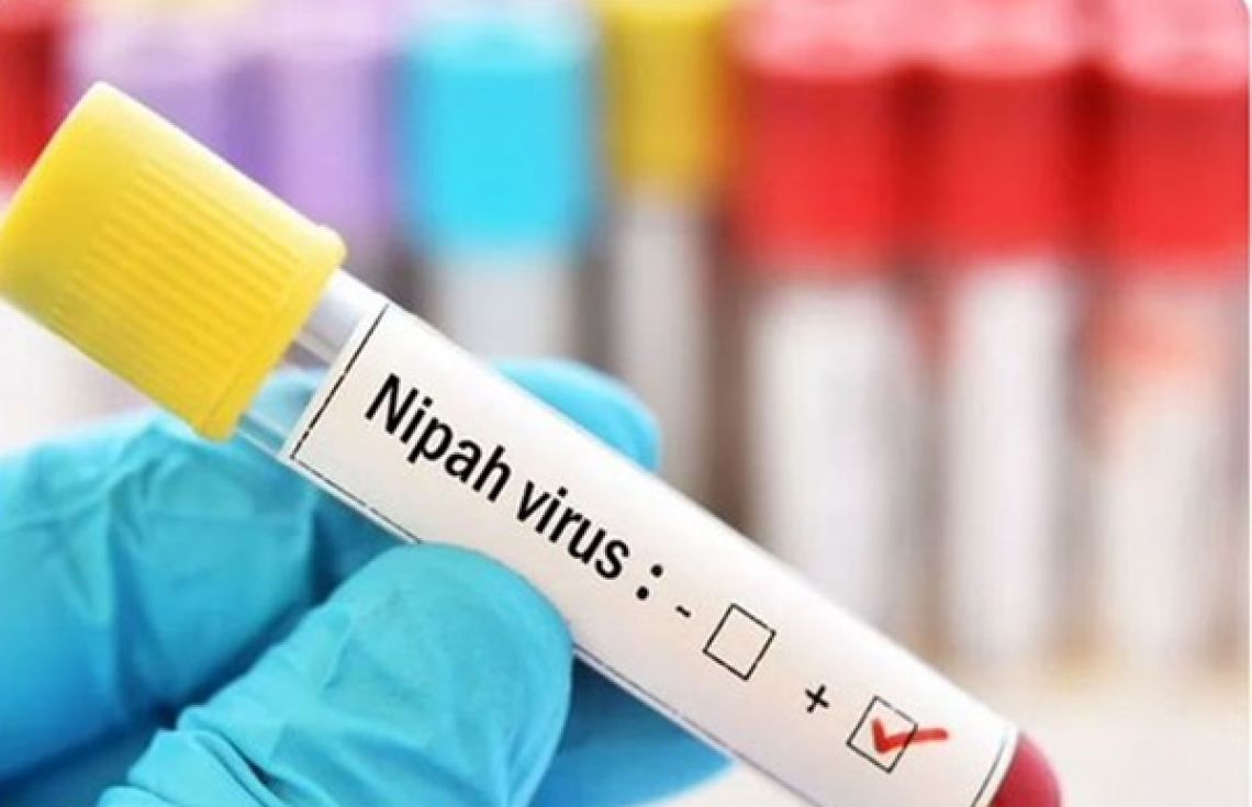 ރާއްޖެއަށް ނިޕާ ވައިރަހުގެ ނުރައްކާ މިވަގުތު ކުޑަ، ހާލަތު އަންނަނީ މޮނިޓާކުރަމުން: އެޗްޕީއޭ