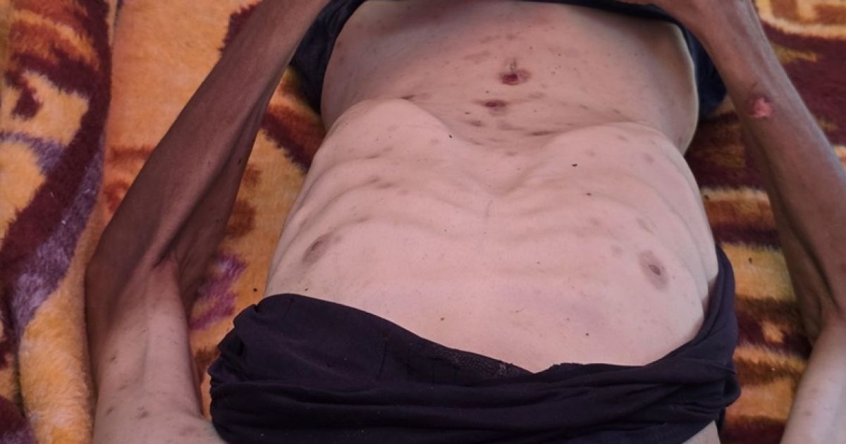 އެއްދުވަސްތެރޭ ޣައްޒާއިން 15 ކުދިން ބަނޑަށް މަރުވެއްޖެ